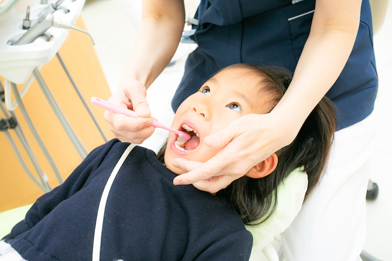 「奥歯の溝」の虫歯について